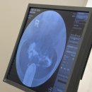 한국영상의학과의원 이미지