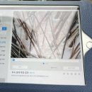 등촌역 미용실 수술 후 받은 두피클리닉 짱 시원해서 회원 고민중인 '이가자헤어비스 등촌역점' 후기