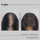 디비전 스칼프 이미지