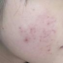 네슈라화장품 | 네슈라 퍼펙트커버 후기