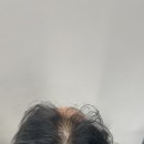 스칼프 메이크업 | 스칼프메이크업 광진구 SMU 두피관리 솔직 후기