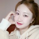 러블리멍 | 애교살 필러 3주차 후기