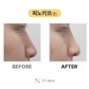 이와이의원 네이버블로그