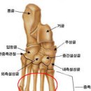 발등이 아픈 이유 5가지와 발등 통증 원인 이미지