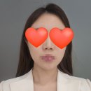 청담피부과 티타늄리프팅 후기(당일/일주일 효과)