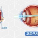 우리안과건강지킴이