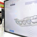 크라운덴트 이미지