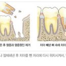 와이편한치과의원 네이버블로그