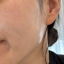 진주피부관리 진주 혁신 채지움뷰티 진주 유일 닥토필 후기