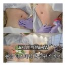 매봉로 | 봉담에스테틱 복부관리 포이뷰 피부&amp;왁싱 후기