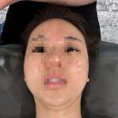 단아한 신발 | 부산 남천동 에스테틱 "단아한 에스테틱" 윤곽관리 후기 (ft. 10년 윤곽관리 장인!)