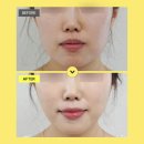 리영의원 - 송파구 | 잠실피부과추천 몽촌토성역 찐피부과 리영클리닉 잠실점!