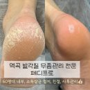 새독일약국 | 부천 역곡 발각질 무좀관리 잘하는곳 페디프로 후기
