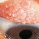 광성소프트 이미지