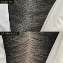 도시여성 - 남구 | 인천 검단신도시 두피문신, 40대 여성 가르마 탈모커버 솔직후기