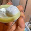 리베리의원 | 영종 리베리의원 줌패스- 흑자제거 후기