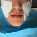 가산한의원 | 가산 새살침 여드름패인흉터치료 잘하는 곳 가산 피부 한의원 1회차 후기