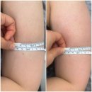 미유테라피 | 이천바디관리 누마레에스테틱 이천에서 팔뚝 관리 받고온 후기