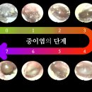 뉴톤보청기광주지사