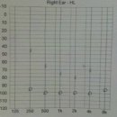 막장인 제 청력 그래프 공개합니다 ㅋ 이미지