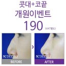 더코성형외과 이미지