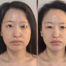 리안 에스테틱 | 대구에스테틱 예비신부 윤곽관리 리안 스킨&바디 솔직후기