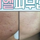 미엘피부관리 이미지