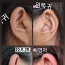 글루타플러스