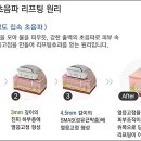 연세탑의원 이미지