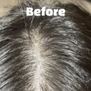 6-305 TS | “진짜로 달라졌어요!🫢” 헤어너지 탈모완화 앰플 2-4일 사용기, 비포→애프터 공개!