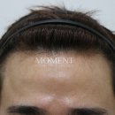 모먼트의원 이미지