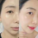 이영애헤어 - 당진시 무수동5길 5 | 강동피부과 고주파 리프팅 이영애 덴서티 후기 탄력관리 (비포&에프터)