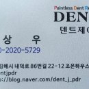 김해덴트 덴트제이에서 받은 후기 적어봐요 !