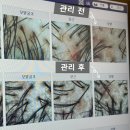 스마트뿌리컨설팅 | 구로 두피관리 모바이오 가산점 예비신랑이랑 커플룸에서 힐링하고 온 솔직 후기