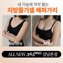 365MC의원 | 가슴지방이식 리얼 후기, 유지기간은 얼마나 갈까?365mc강남본점 지방줄기셀 배파가리