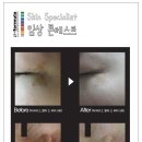 애 스킨케어