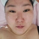 석우초교 | [제이뷰티 피부힐링샵] 동탄 피부샵 피부리프팅 라쎄라 후기