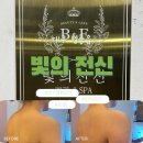 빛으로병원 | 대구 현풍읍 신부관리 빛의 전신 드레스핏 경락 후기