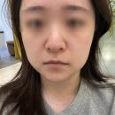 대신의원 | 강남 신논현 레이저리프팅 울쎄라 수면 대신 울트라인 후기 쁨의원 내돈내산