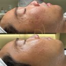 룩서스플라즈마라이너강서지사 | 룩서스 플라즈마 라이너, 뷰티샵에 필요한 단 하나의 선택!
