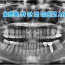 찬치과기공소 이미지