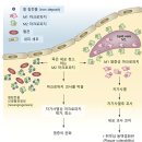 Re:Re:Re:급성, 만성 염증에서의 마크로파지 분극화(Macrophage polarization in acute and chronic inflammation) 이미지