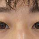 눈사랑안경 위드렌즈 용호점 이미지