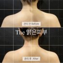 The 예쁜 피부 이미지