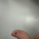 행신약국 | 일상) 분실물 찾는 방법 그리고 캐리어에 눈팅방팅되고 손 집혔는데 피가 고인 후기 ..