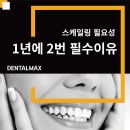 (주)덴탈맥스 | 🧹 스케일링 필요성 - 1년에 2번은 꼭 받아야 하는 이유