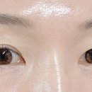 알프스안경위드렌즈 이미지