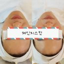 피부체인지