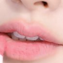 복복케이스