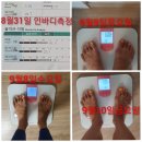 라이프닝효과 딥톡스효과 다이어트후기 리얼다이어트후기 인셀덤라이프닝효과